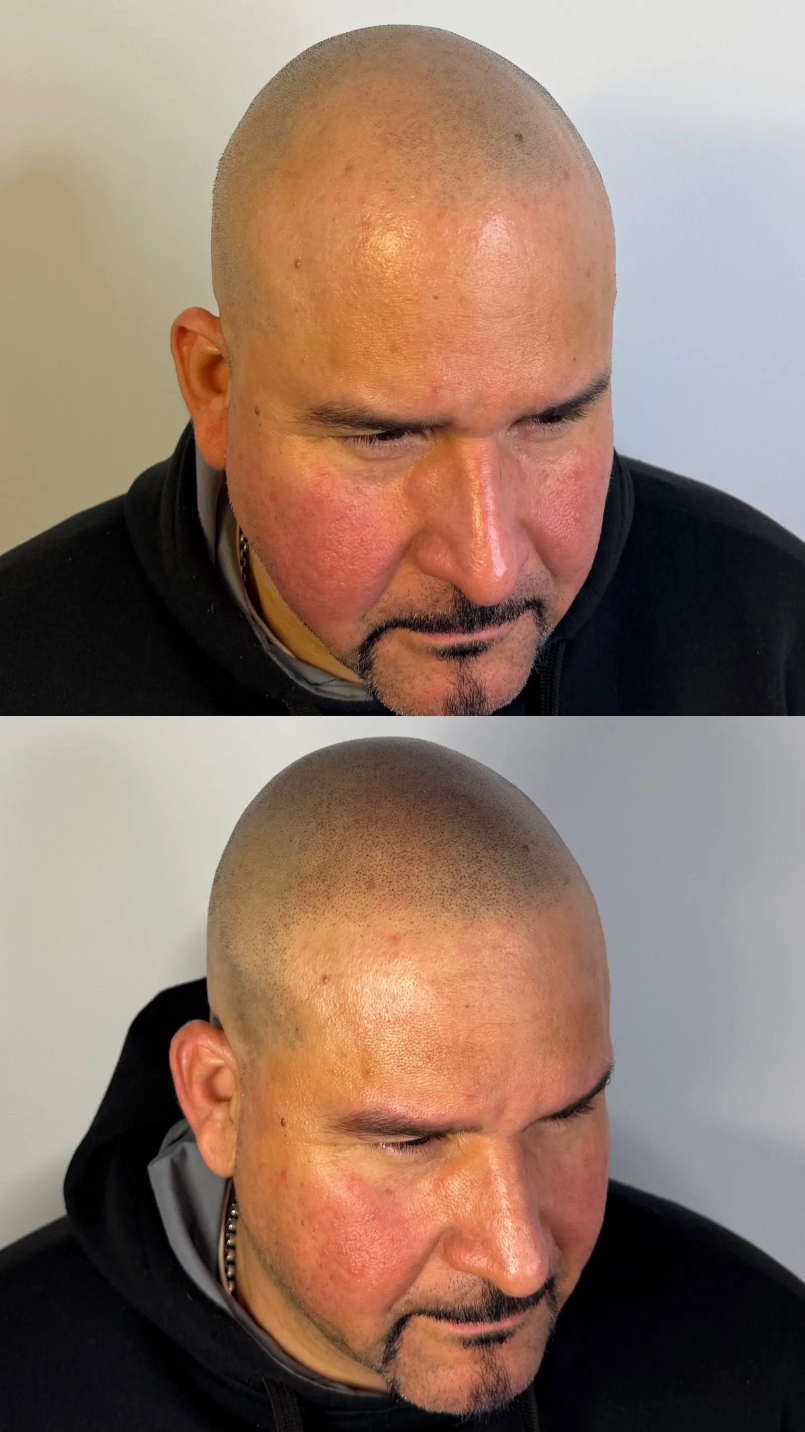 Micropigmentación de cejas y labios en Albacete - ACUS TATTOO